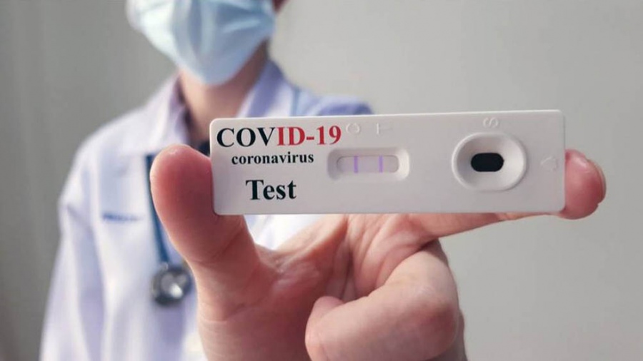 Lee más sobre el artículo Llegan los autotest de coronavirus a las farmacias para su venta al público